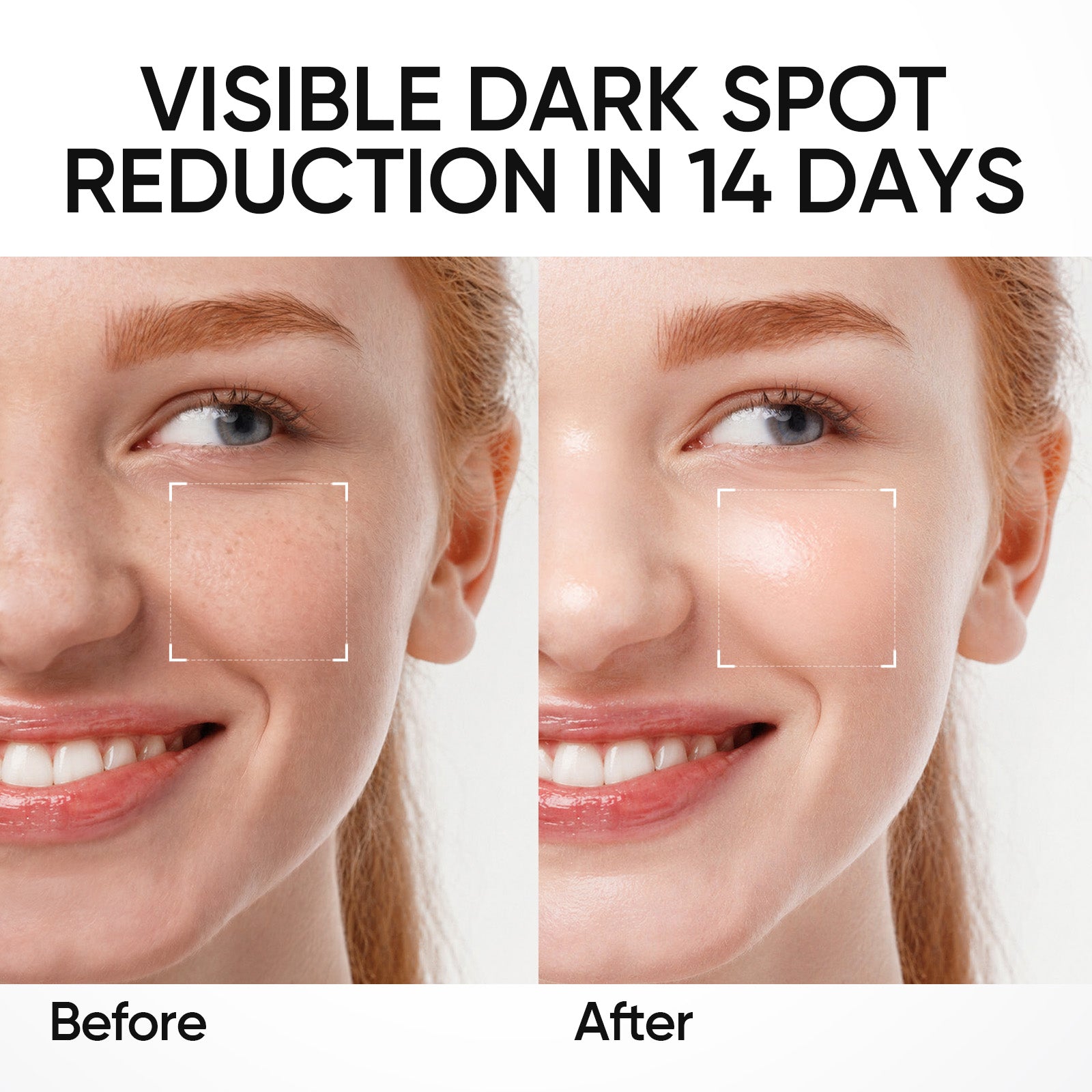 377 Dark Spot Serum