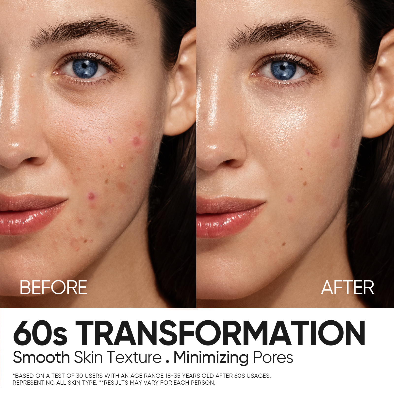 12% AHA BHA PHA LHA Peeling Solution Serum