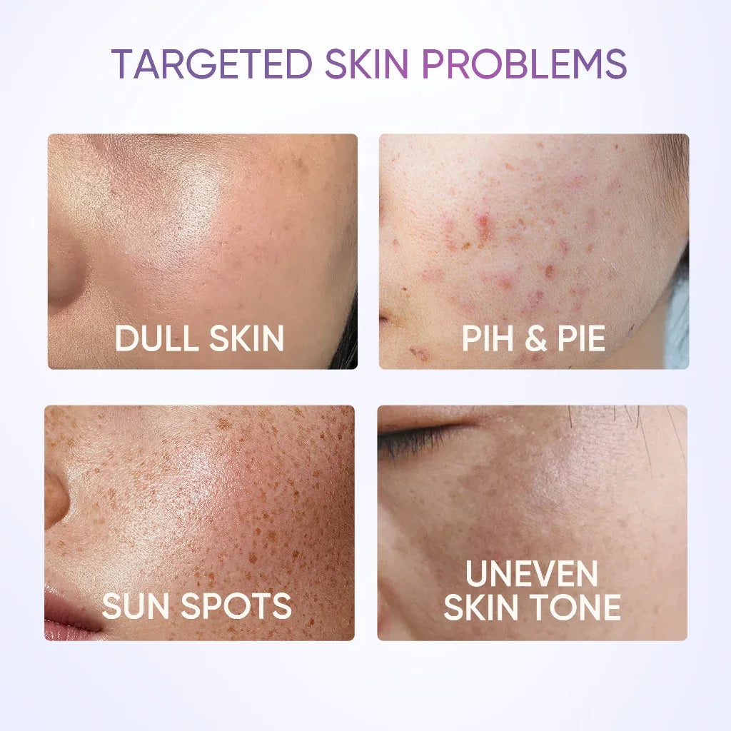 SymWhite 377 Dark Spot Moisture Gel