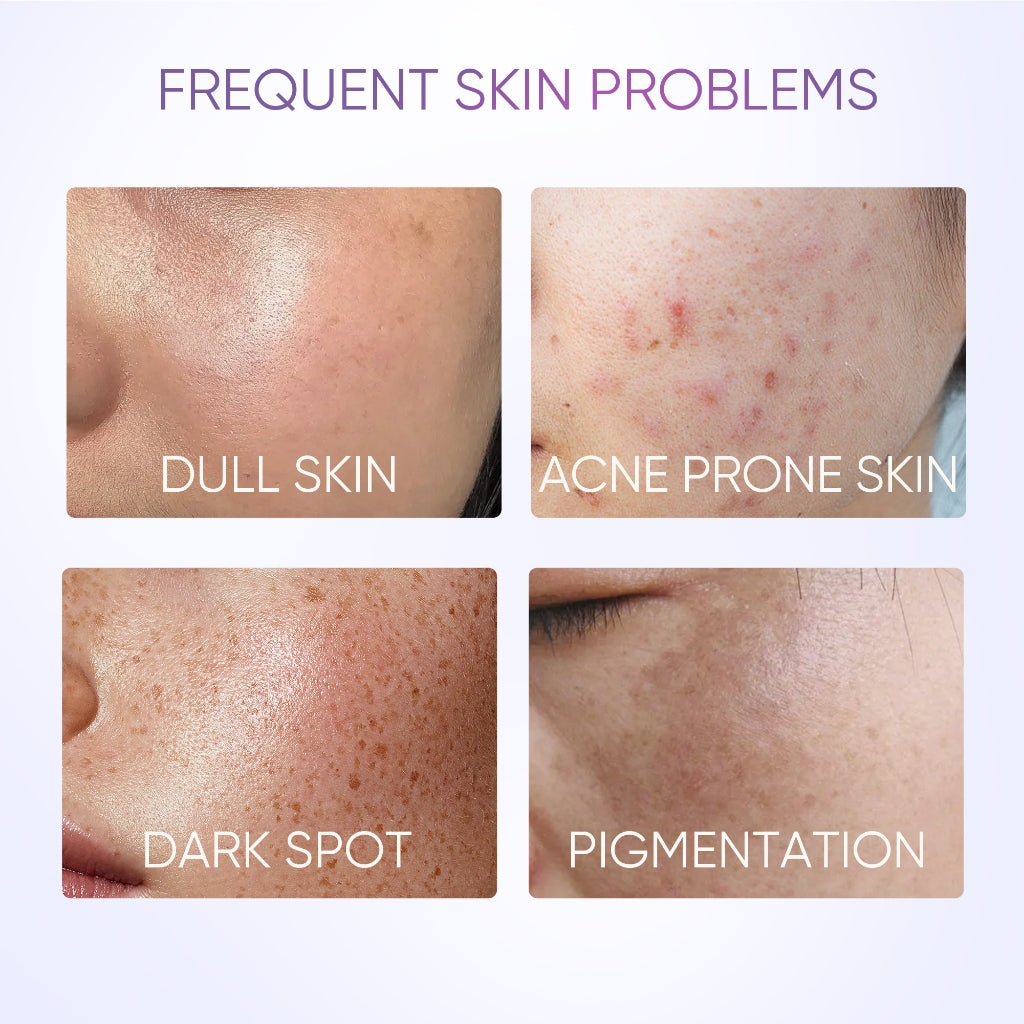 SymWhite 377 Dark Spot Eraser Serum