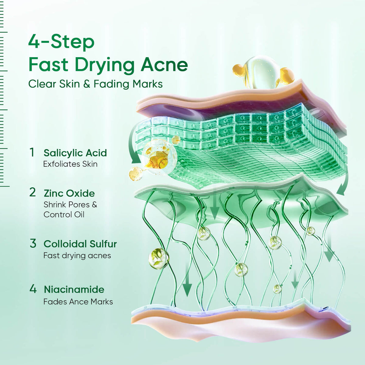 Acne Drying Lotion Overnight Spot Treatment